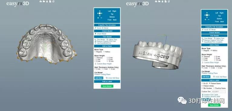 牙科3D打印